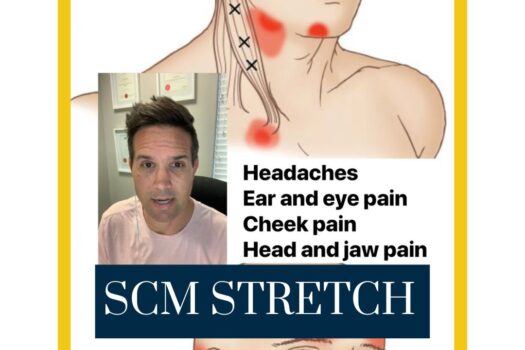 Understanding the SCMs: Your Guide to Neck Pain Relief